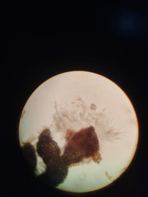 askospore venturia inaequalis