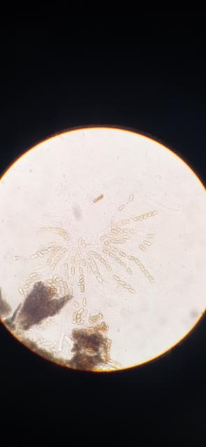 askospore,venturia inaequalis,jabuka