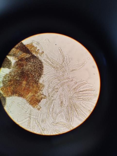 askospore venturia inaequalis,jabuka