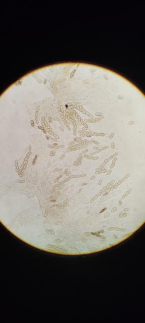askospore venturia inaequalis,jabuka