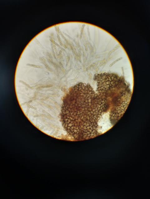 askospore venturia inaequalis
