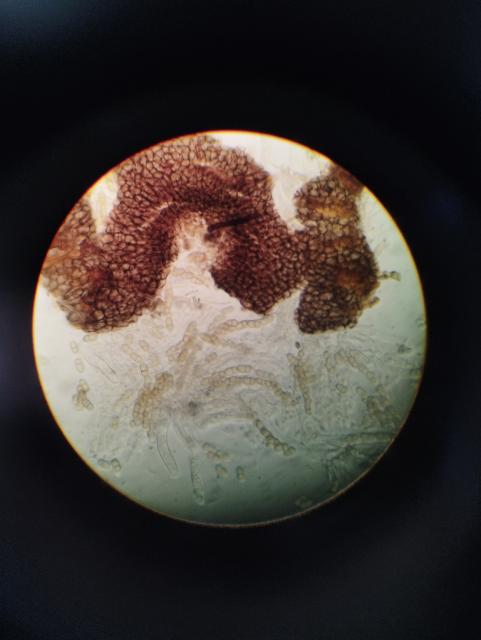 askospore,venturia inaequalis