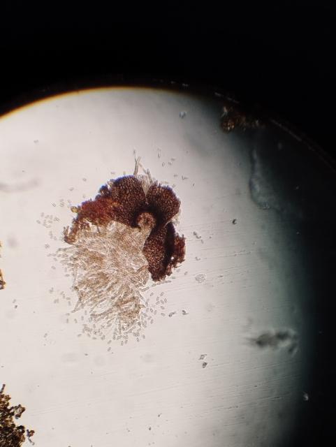 pseudotecija